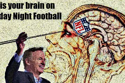 The NFL Refuses To Ban Lobotomies